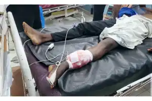 இலங்கைக் கடற்படையினரின் துப்பாக்கிச்சூட்டில் காயமடைந்த மேலும் இரண்டு இந்திய மீனவர்கள் வைத்தியசாலையில்...