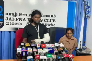 யாழ்.நெல்லியடி பொலிஸார் தன்னை கைது செய்து கையையும் முறித்துள்ளதாக  நந்தகுமார் இலங்கேஸ்வரன்...
